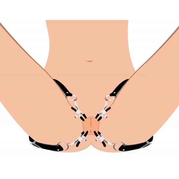 Spread Xl Labia Spreader Straps