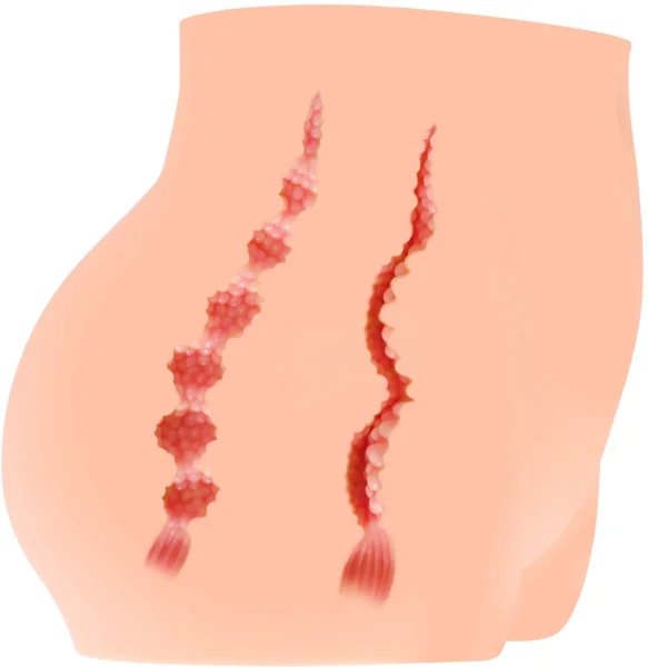 Cherry Mini Hip + Pussy