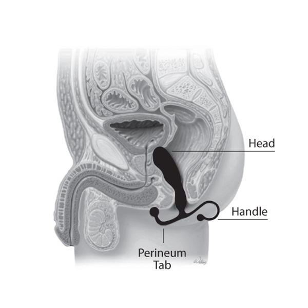 Aneros Helix Syn Prostate Massager