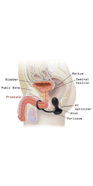 Prostatic Play Rover Silicone C-ring and Prostate Plug