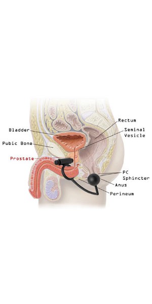 Prostatic Play Odyssey Vibrating Cock Ring and Anal Stimulator