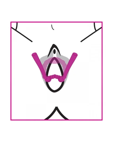 Petal Pusher Silicone Labia Spreader