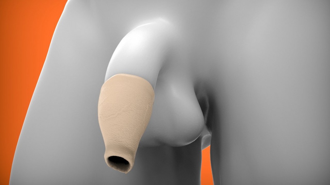 Oxballs Hood Moreskin Foreskin Set — image 5 of 10