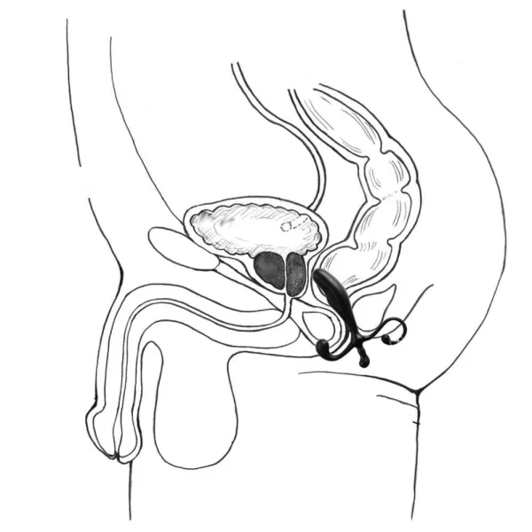 Prostate Massager