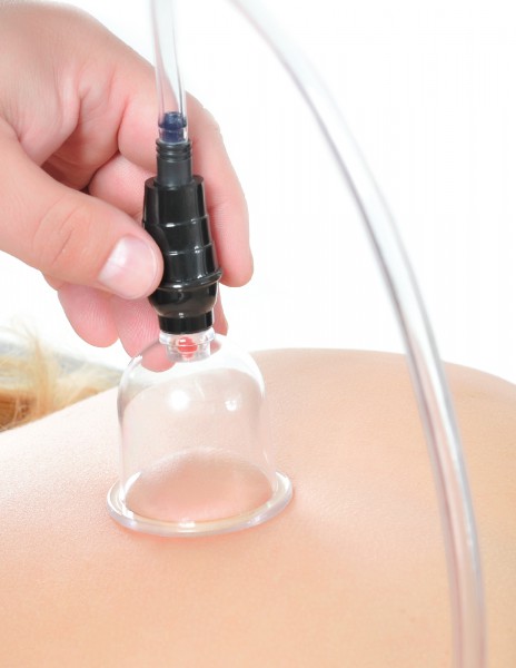 Beginners Cupping Set