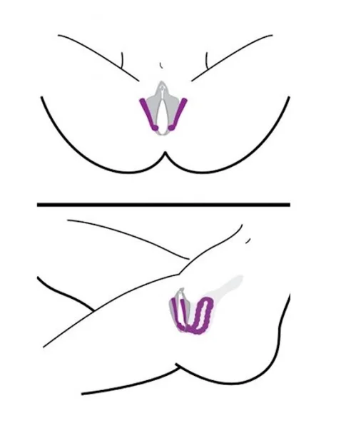 Oral Enhancing Labia Spreader