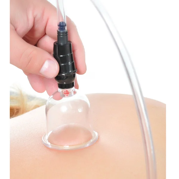 Fetish Fantasy Series Beginner's Cupping Set — image 14 of 16