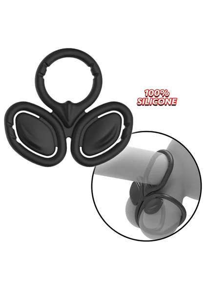 My Cock Ring The Triad Cock Ring & Ball Cinch — image 9 of 10