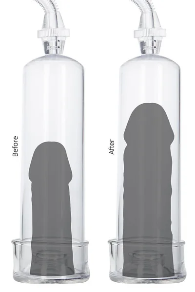 California Exotic 7.75" Penis Pump, 4.5" Prostate Massager & 3 Cock Rings — image 12 of 12
