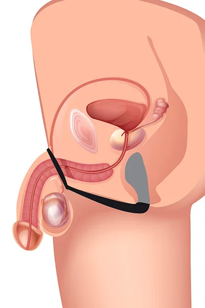 Prostatic Play Explorer II Prostate Stimulator and Cock Ring — image 4 of 6