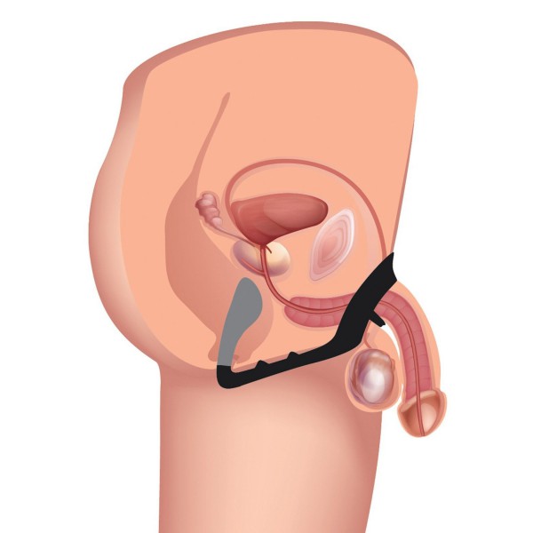 Prostatic Play Excursion Silicone Anal Plug