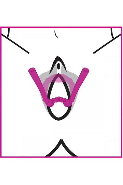 Frisky Beaded Silicone Labia Spreader — image 14 of 15