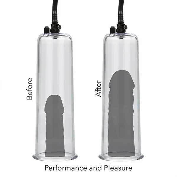 Optimum Series Max Results Penis Pump Set  | Penis Enlargement Kit by Cal Exotics — image 15 of 16
